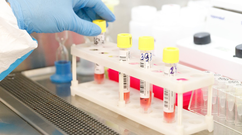 Після свят на Полтавщині зафіксували зниження рівня інфекційних захворювань