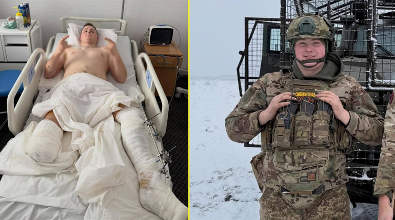 Випускник Переяславського коледжу Вадим Пашко отримав тяжке поранення: триває збір на реабілітацію
