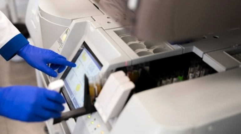 Печінкові проби: які аналізи входять, як підготуватися і як читати результати