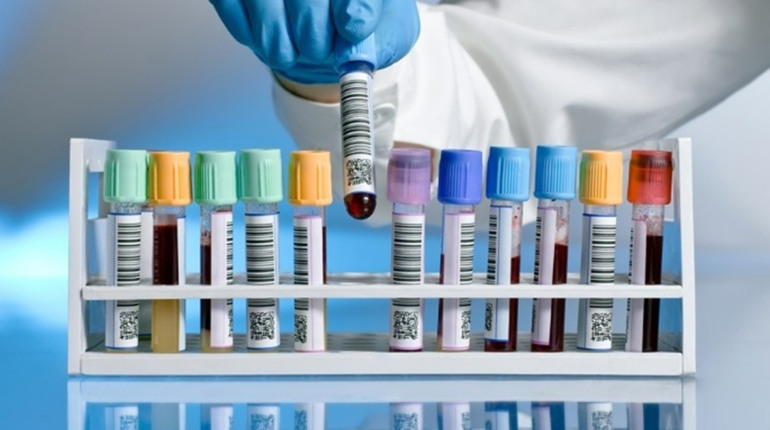 ТОП-10 лабораторних пробірок для медичних і дослідницьких лабораторій