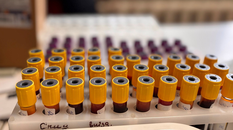 У Первомайську відбувся день донації: як це було та коли наступний візит — дізнались журналісти