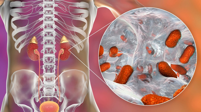 Топ-10 фруктів, корисних для нирок при пієлонефриті