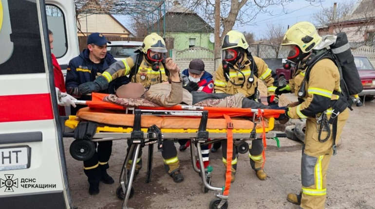 У Золотоноші під час пожежі постраждав чоловік: його госпіталізували з опіками