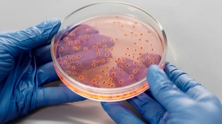 Чому кандидоз виникає: основні причини та фактори ризику