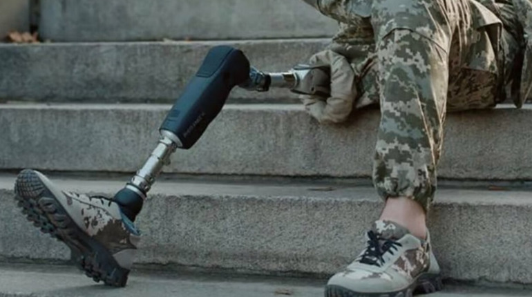 Як отримати безоплатний протез: інструкція для військових і цивільних