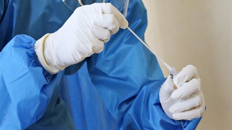 У ректора херсонського вишу підтвердився COVID-19, коли легені вже були уражені на 20%
