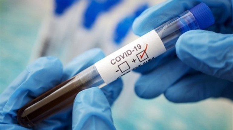 У Южному 56 осіб захворіло на Covid-19 за останню добу