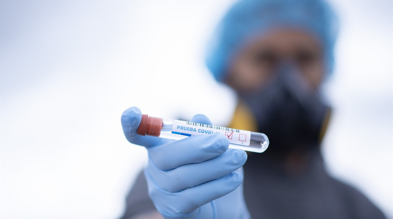 У Луганській області ще троє хворих на COVID-19: що про це відомо