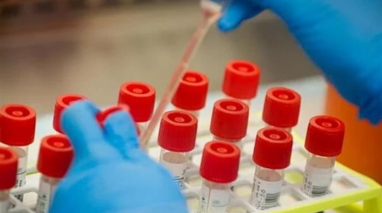 У Кагарлицькому районі протягом вихідних виявили ще два випадки коронавірусу