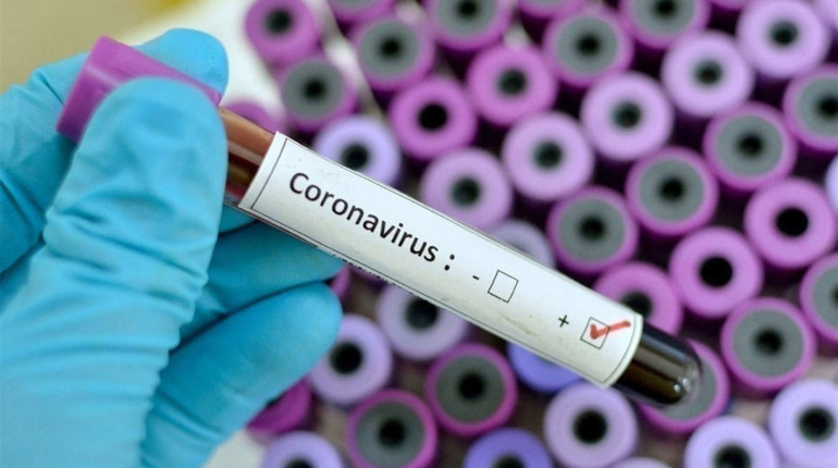 В Україні за добу COVID-19 підтвердили у 920 людей: яка ситуація у Луганській області і в районі