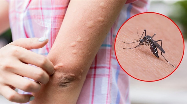 Небезпечні комахи навесні: потенційні епідемічні ризики та заходи контролю