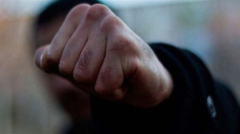 Повідомили про підозру черкащанину, який жорстоко побив чоловіка