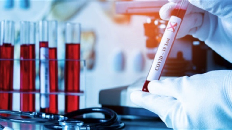 У Сватівському районі +70 хворих на COVID-19: яка ситуація з поширенням хвороби у Луганській області