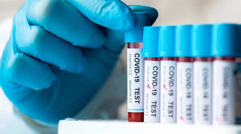 COVID-19 в Україні: яка ситуація з поширенням на Сватівщині і у Луганській області на ранок 1 грудня