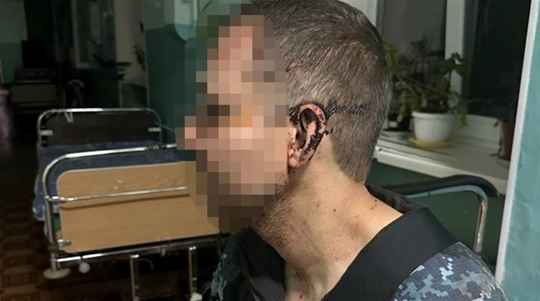 У військовій частині на Одещині побили військового: почали розслідування
