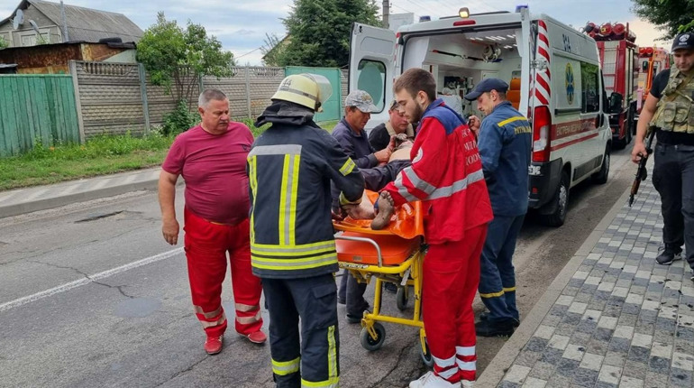 На Фастівщині загорілася дерев'яна баня. Постраждали дві людини
