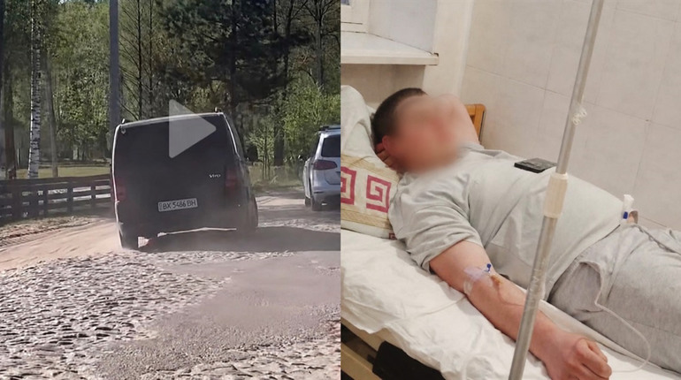 На Сарненщині побили 17-річного хлопця: що відомо про інцидент і стан потерпілого