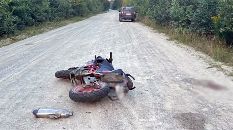 Звягелянин потрапив до реанімації після падіння з мотоцикла