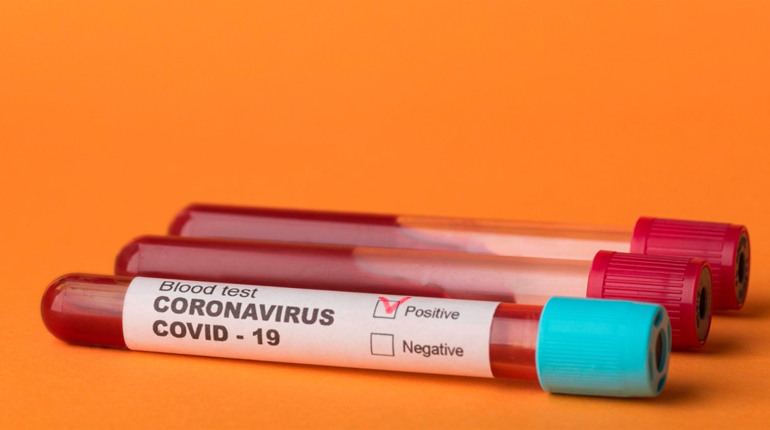 На порозі «червоної» зони: скільки хворих на COVID-19 на Сватівщині і Луганщині на 27 жовтня