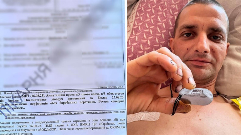 Городоччани збирають кошти на протезування земляку. Роман Цимбалюк втратив обидві ноги та руку