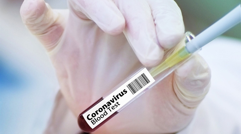 За останню добу в Україні підтвердили 62 випадки захворювання на COVID-19. Яка ситуація у Сватовому