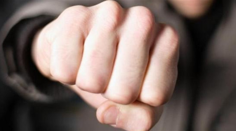 На Черкащині судитимуть чоловіка за нанесення тяжких тілесних ушкоджень