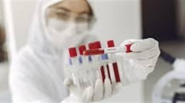 Пандемію скасували, але у Шосткинській громаді люди продовжують помирати від ковіду