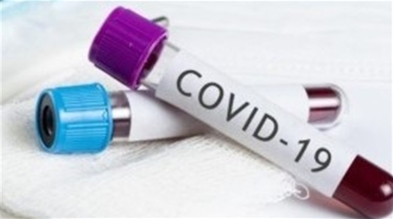 COVID-19: в Україні – понад 15 тисяч за добу, в області – майже 550. Додалося хворих і  у місті