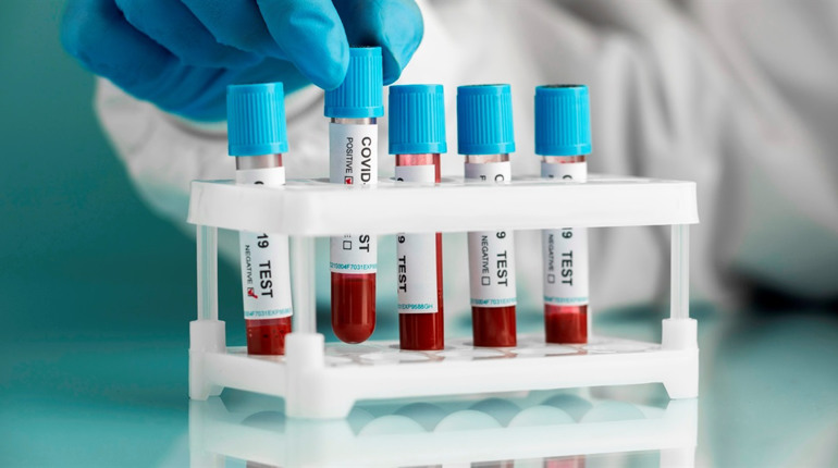 Коронавірус у Сватівському районі: статистика поширення COVID-19 на 2 листопада 2021