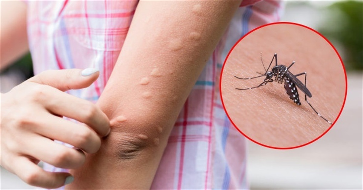 Небезпечні комахи навесні: потенційні епідемічні ризики та заходи контролю