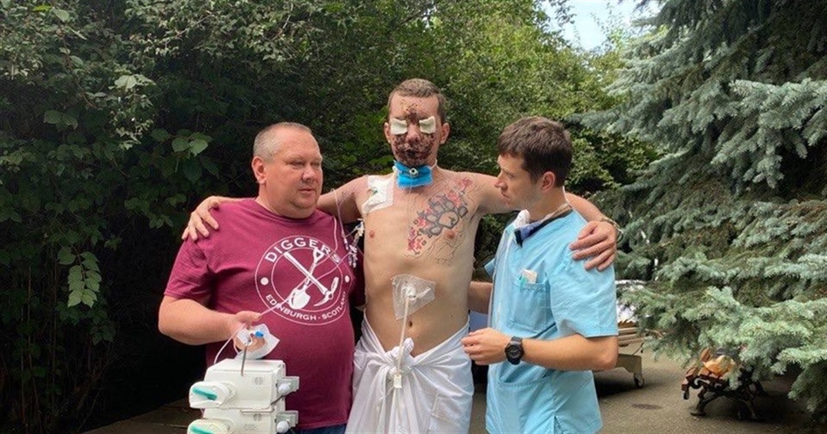 Демінер Владислав Єщенко втратив зір та слух на фронті. Тепер він бореться за своє здоров'я