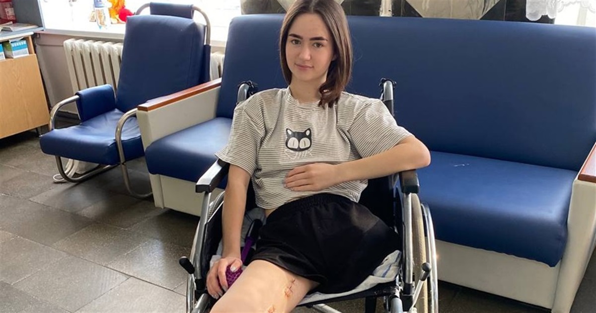 Мам, а ноги уже нет. 19-летняя студентка Анастасия пострадала во время ракетного удара в Краматорске
