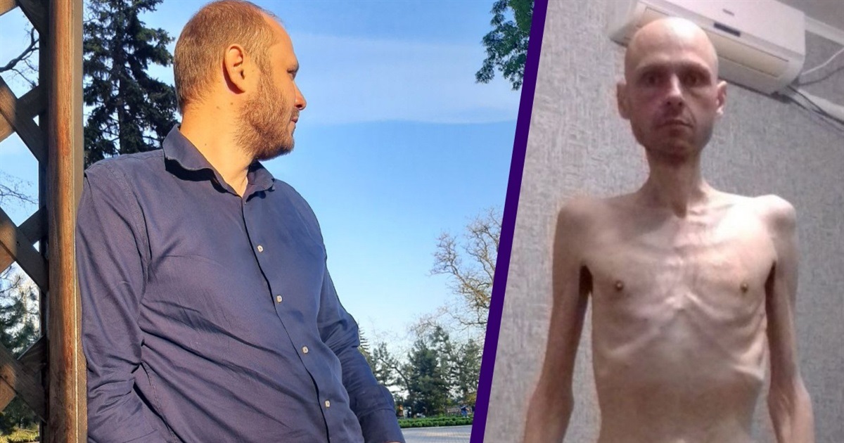 Місяць тому Володимир Цема-Бурсов повернувся з полону. Майже за 2 роки чоловік схуд на 38 кілограмів
