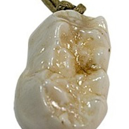 Медвежий зуб