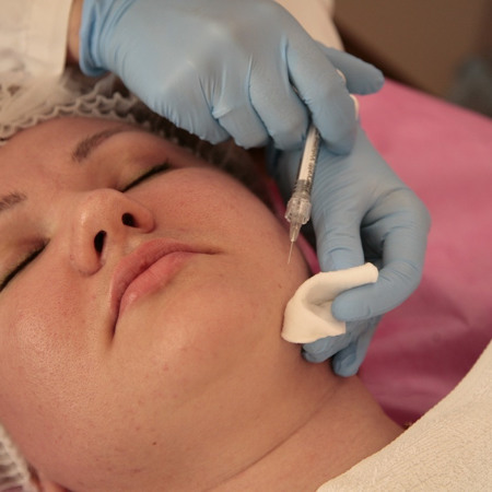 Мезотерапія (біоревіталізація)