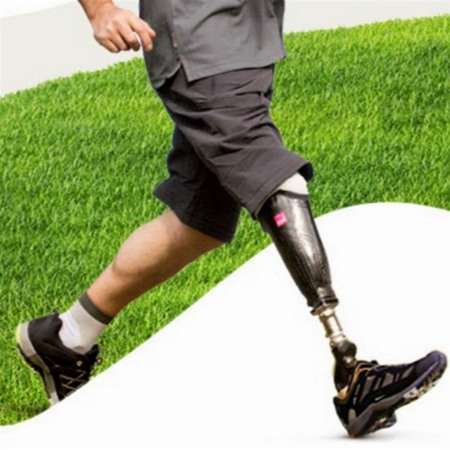 Бионические имплантаты