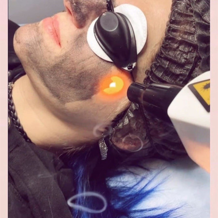 Апаратна косметологія